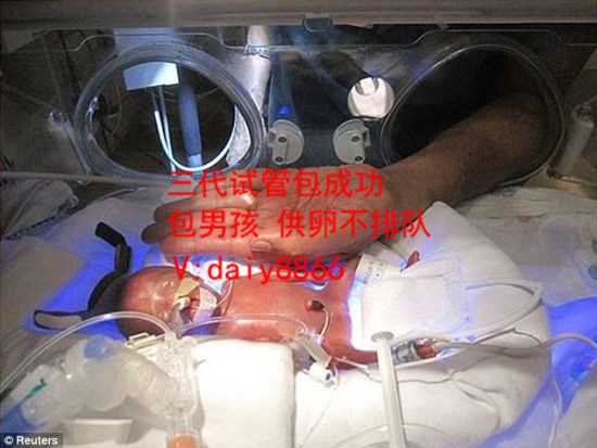 吉林正规供卵_2022上海集爱医院做第三代试管婴儿的成功率怎么样?
